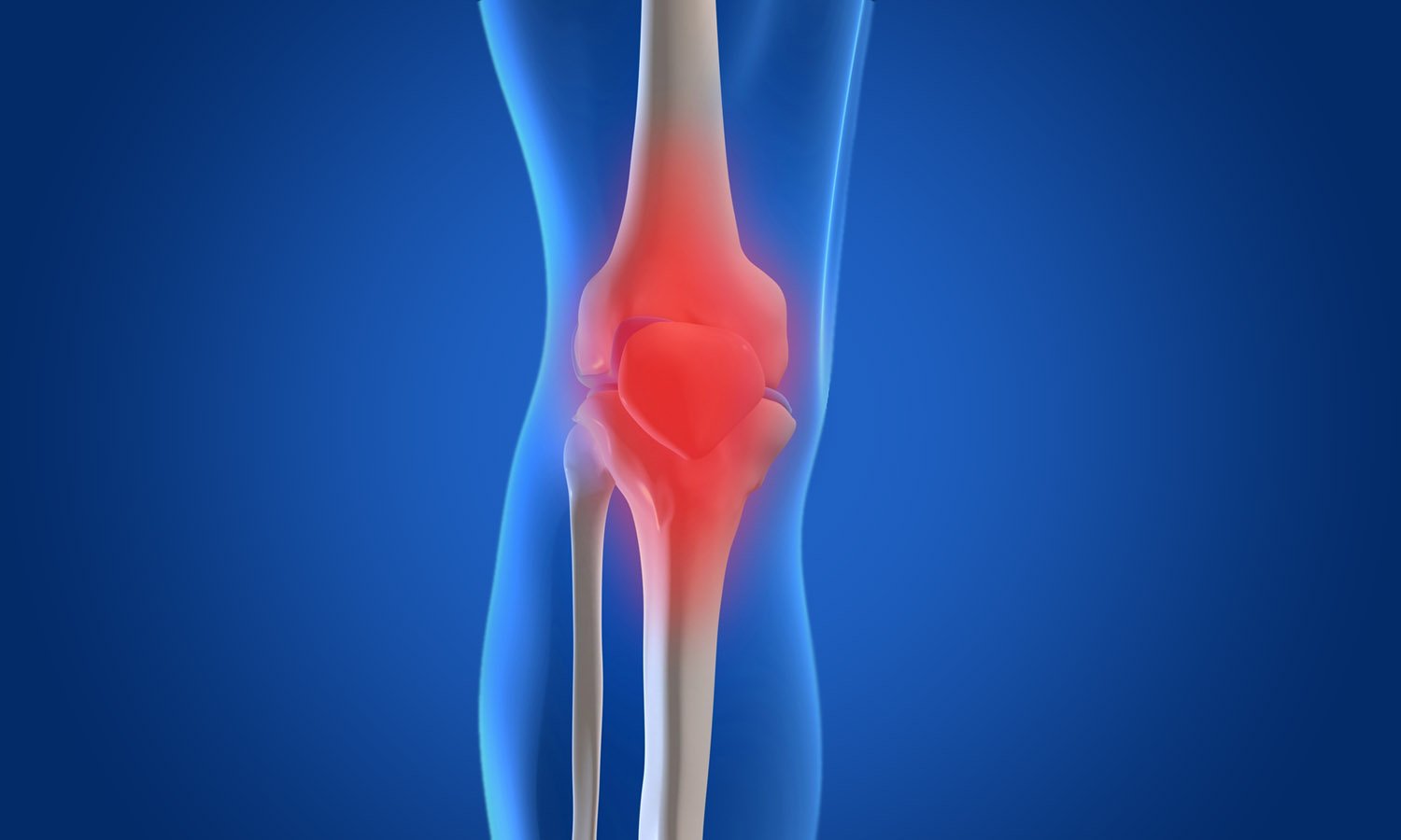 Osteoarthritis​