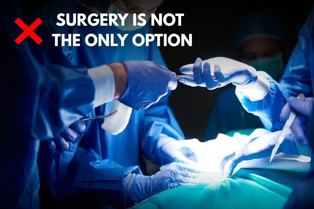 SURGERY IS NOT THE ONLY OPTION