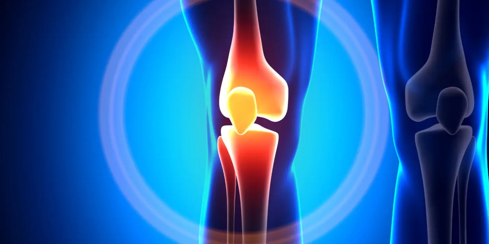 Knee Pain